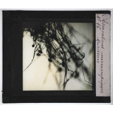 Quelques exemples d'observations microscopiques. Moisissure.
