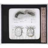 Maladies de la peau causées par des parasites. 2e série: insectes et champignons. 1° Sillon de la gale - 2° Sarcoptes scabiei.