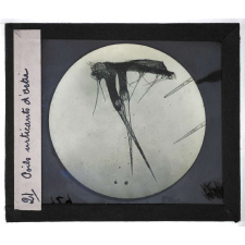 Quelques exemples d'observations microscopiques. Poils urticants d'ortie.