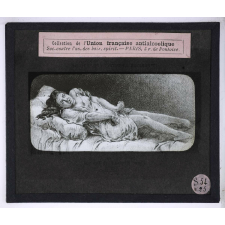 Vues anti-alcooliques. 1ère période; période épileptoïde.