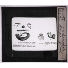 Les Animaux parasites de l'homme. Trichocéphale, strongle géant.