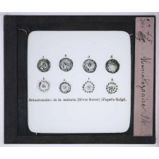 Le Microscope. Ce qu'il permet de voir dans le corps humain. Hématozoaire.