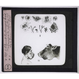 Maladies de la peau causées par des parasites. 2e série: insectes et champignons. 1° Filament d'Actinomyces bovis - 2° Actinomycose du maxillaire inférieur chez la femme, chez le bœuf.