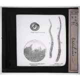 Les Animaux parasites de l'homme. Trichine.