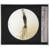 Quelques exemples d'observations microscopiques. Hydre d'eau douce.