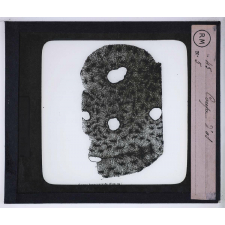 Le Microscope. Ce qu'il permet de voir dans le corps humain. Coupe d'os.