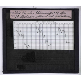Le Paludisme. Courbes thermiques de malades atteints du paludisme.