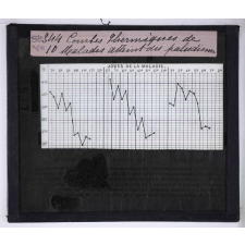 Le Paludisme. Courbes thermiques de malades atteints du paludisme.