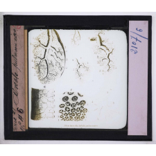 Respiration. Alvéole pulmonaire.