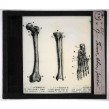 Squelette. Fémur, tibia, péroné.
