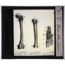 Squelette. Fémur, tibia, péroné.