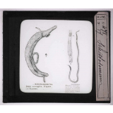 Les Animaux parasites de l'homme. Schistosomum.