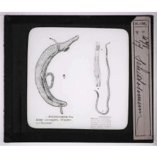 Les Animaux parasites de l'homme. Schistosomum.