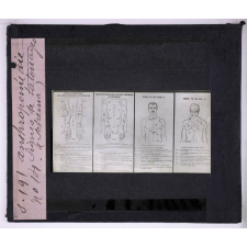 L'Anthropométrie appliquée à l'identification judiciaire - système A. Bertillon. Signes de tatouages (schéma).
