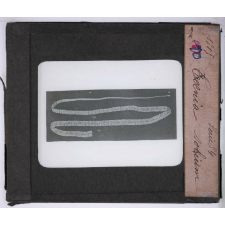 Hygiène. Tænia solium.