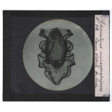 Quelques exemples d'observations microscopiques. Larve d'étoile de mer.