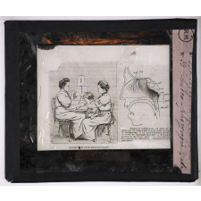 Prophylaxie des maladies contagieuses. 1ère série. Transmises par les déjections, les matières fécales, l'eau souillée; les sécrétions respiratoire. Lavage de la cavité bucco-pharyngée.