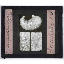 Circulation du sang. Système lymphatique digestif.