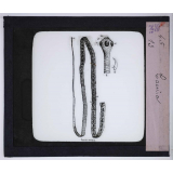 Le Microscope. Ce qu'il permet de voir dans le corps humain. Tænia.