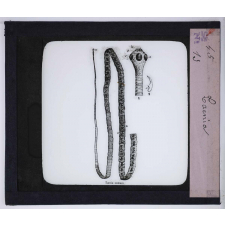 Le Microscope. Ce qu'il permet de voir dans le corps humain. Tænia.