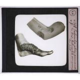 Maladies de la peau causées par des parasites. 2e série: insectes et champignons. Tuberculose ulcéro-gommeuse du bras - Tuberculose verruqueuse du pied.