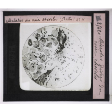 Les Maladies du cuir chevelu. Microbes divers du cuir chevelu.