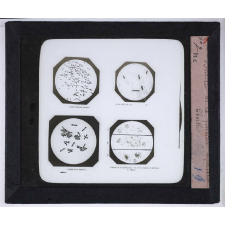 Le Microscope. Ce qu'il permet de voir dans le corps humain. Bacille d'Eberth. 