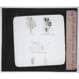 Microscope nature. Antherozoïdes des algues.