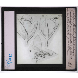 Biologie florale. Blastophaga fécondant une femelle - sortant de la galle, insecte femelle.