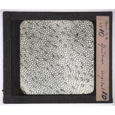 Microscope nature. Epiderme végétal.