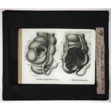 La Digestion. Valvule iléo-cæcale.