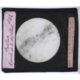 Pasteur. Microbe de la diphtérie.