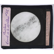 Pasteur. Microbe de la diphtérie.