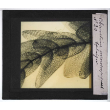 Quelques exemples d'observations microscopiques. Sphaigne.
