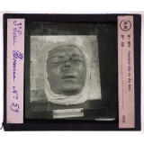 Conférence antivénérienne faite à des officiers et soldats. 3ème Série. Gomme des os du nez.