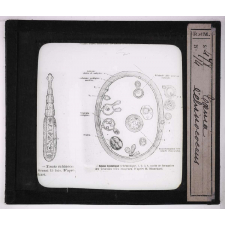 Les Animaux parasites de l'homme. Taenia echinococcus.