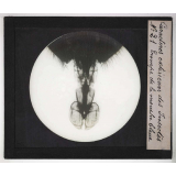 Caractères extérieurs des insectes. Trompe de la mouche bleue.