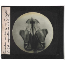 Caractères extérieurs des insectes. Aiguillon de l'abeille.