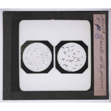 Hygiène. Microbe de la grippe.