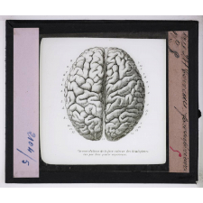 Système nerveux. Cerveau. Face supérieure.