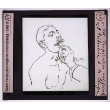 Soins d'urgence aux blessés et malades. Respiration artificielle. Préhension de la langue.