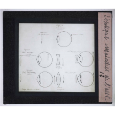 Phénomènes généraux de l'optique et applications. Maladies de l'œil.