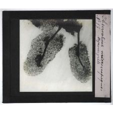 Quelques exemples d'observations microscopiques. Myxomycète.