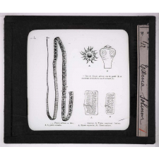 Les Animaux parasites de l'homme. Taenia solium.