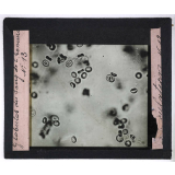 Circulation du sang. Globules du sang de l'homme.