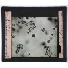 Circulation du sang. Globules du sang de l'homme.