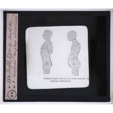 Les Dessanglés du ventre. Profils types du bon et du mauvais sanglage abdominal.