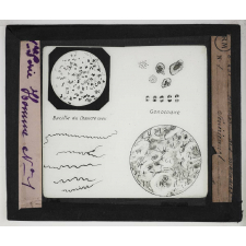 Les Maladies vénériennes. Microbes des maladies vénériennes.