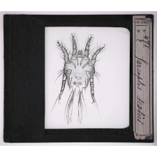 Les Animaux parasites de l'homme. Sarcoptes scabiei.