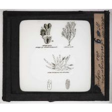 Microscope. Anthérozoïdes des algues.
